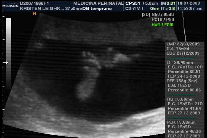 Baby Boy #2 - 15 weeks - foot