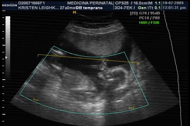 Baby Boy #2 - 15 weeks - sucking thumb